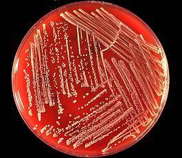 Coagulase negative staphylococcus